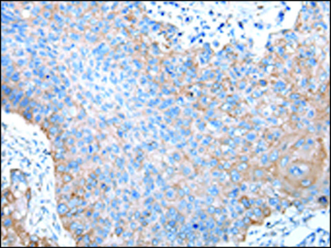 Anti-PTGIR affinity isolated antibody