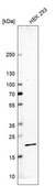 Anti-RPS11 antibody produced in rabbit Prestige Antibodies® Powered by Atlas Antibodies, affinity isolated antibody, buffered aqueous glycerol solution