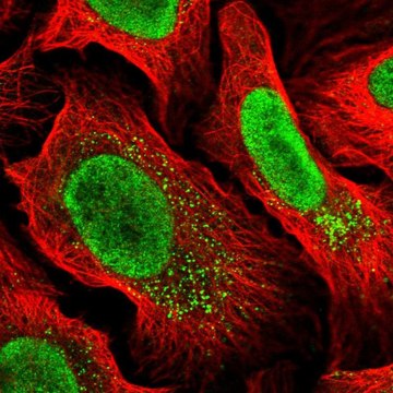 Anti-MYCBP2 antibody produced in rabbit Prestige Antibodies&#174; Powered by Atlas Antibodies, affinity isolated antibody