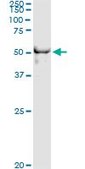 Monoclonal Anti-DYX1C1 antibody produced in mouse clone 6G1, purified immunoglobulin, buffered aqueous solution