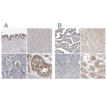 抗-PCM1 兔抗 Prestige Antibodies&#174; Powered by Atlas Antibodies, affinity isolated antibody, buffered aqueous glycerol solution, Ab2