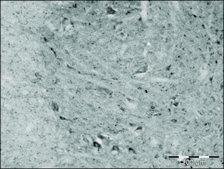 Anti-Granulin (C-terminal) antibody produced in rabbit ~1.0 mg/mL, affinity isolated antibody