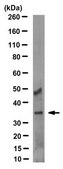 Anti-Annexin A3 Antibody, clone 9996-1-3M1/3L7-5 clone 9996-1-3M1/3L7-5, from mouse