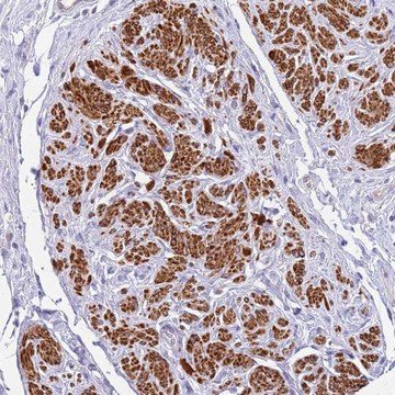 Anti-MVD antibody produced in rabbit Prestige Antibodies&#174; Powered by Atlas Antibodies, affinity isolated antibody, buffered aqueous glycerol solution