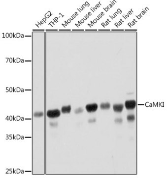 Anti-CaMKI Antibody, clone 4P4K9, Rabbit Monoclonal