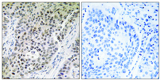 Anti-ZNF608 antibody produced in rabbit affinity isolated antibody