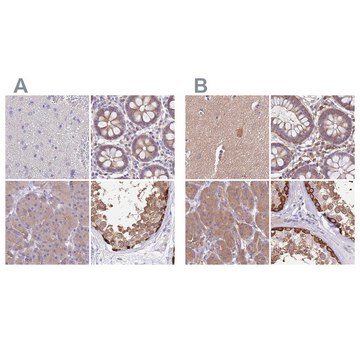 Anti-STIP1 antibody produced in rabbit Prestige Antibodies&#174; Powered by Atlas Antibodies, affinity isolated antibody, buffered aqueous glycerol solution