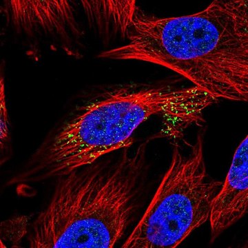 Anti-ABHD14A antibody produced in rabbit Prestige Antibodies&#174; Powered by Atlas Antibodies, affinity isolated antibody