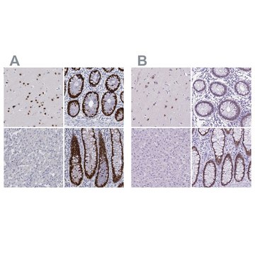 Anti-SATB2 antibody produced in rabbit Prestige Antibodies&#174; Powered by Atlas Antibodies, affinity isolated antibody, buffered aqueous glycerol solution