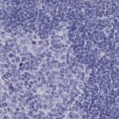 Anti-PSMB11 antibody produced in rabbit Prestige Antibodies® Powered by Atlas Antibodies, affinity isolated antibody, buffered aqueous glycerol solution