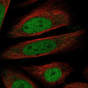 Anti-Rnf20 Antibody Produced In Rabbit Prestige Antibodies&#174; Powered by Atlas Antibodies, affinity isolated antibody, buffered aqueous glycerol solution