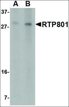 Anti-RTP801 (ab2) antibody produced in rabbit affinity isolated antibody, buffered aqueous solution