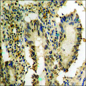 Anti-phospho-p38 MAPK (pTyr182) antibody produced in rabbit affinity isolated antibody