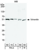 Rabbit anti-Vimentin Antibody, Affinity Purified Powered by Bethyl Laboratories, Inc.