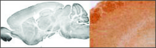 Anti-GABRA3 (AB1) antibody produced in rabbit IgG fraction of antiserum