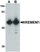Anti-KREMEN1 antibody produced in rabbit affinity isolated antibody