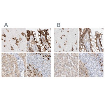 Anti-LRRC59 antibody produced in rabbit Prestige Antibodies&#174; Powered by Atlas Antibodies, affinity isolated antibody, buffered aqueous glycerol solution