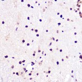 Anti- JMJD6 antibody produced in rabbit