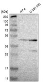 Anti-ZSCAN30 antibody produced in rabbit Prestige Antibodies® Powered by Atlas Antibodies, affinity isolated antibody, buffered aqueous glycerol solution