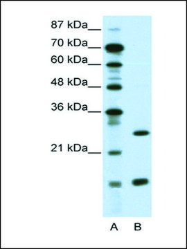 Anti-CEBPG antibody produced in rabbit affinity isolated antibody