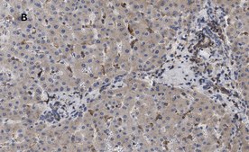 Anti-LDL Receptor Antibody, clone 2N19, ZooMAb® Rabbit Monoclonal recombinant, expressed in HEK 293 cells