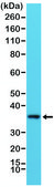Anti-MYD88 antibody, Rabbit Monoclonal recombinant, expressed in HEK 293 cells, clone RM306, purified immunoglobulin