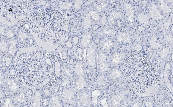 Anti-PLA2R1 Antibody, clone 1D5, ZooMAb&#174; Rabbit Monoclonal recombinant, expressed in HEK 293 cells