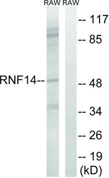 Anti-RNF14 antibody produced in rabbit affinity isolated antibody