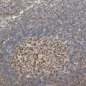 Anti-GINS4 antibody produced in rabbit Prestige Antibodies® Powered by Atlas Antibodies, affinity isolated antibody, buffered aqueous glycerol solution, Ab1