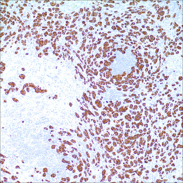 Cytokeratin (35betaH11) Mouse Monoclonal Antibody