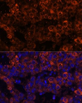 Anti-SERPINE1 antibody produced in rabbit