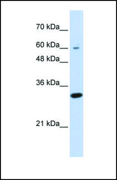 Anti-LRRC57, (N-terminal) antibody produced in rabbit affinity isolated antibody