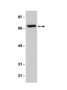 Anti-p68 Antibody, clone204 clone 204, Upstate&#174;, from mouse