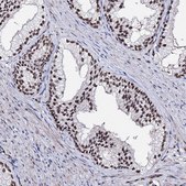 Anti-CHMP7 antibody produced in rabbit Prestige Antibodies® Powered by Atlas Antibodies, affinity isolated antibody, buffered aqueous glycerol solution