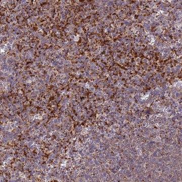 Anti-IL21R antibody produced in rabbit Prestige Antibodies&#174; Powered by Atlas Antibodies, affinity isolated antibody, buffered aqueous glycerol solution