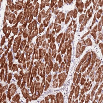 Anti-ART5 antibody produced in rabbit Prestige Antibodies&#174; Powered by Atlas Antibodies, affinity isolated antibody, buffered aqueous glycerol solution