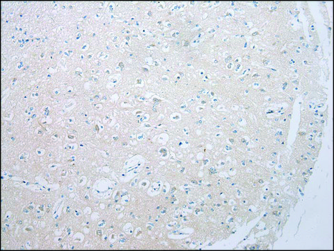 Anti-ADAMTS8 affinity isolated antibody