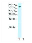 Anti-TSC22D2 (AB1) antibody produced in rabbit affinity isolated antibody