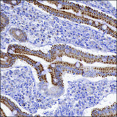 Anti-FRMD6 antibody produced in rabbit Prestige Antibodies® Powered by Atlas Antibodies, affinity isolated antibody, buffered aqueous glycerol solution