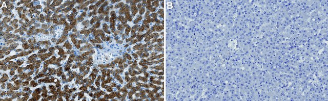 Anti-HSD17B13 Antibody, clone 2B3 ZooMAb&#174; Rabbit Monoclonal recombinant, expressed in HEK 293 cells