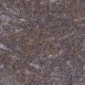 Anti-PSMB10 antibody produced in rabbit Prestige Antibodies® Powered by Atlas Antibodies, affinity isolated antibody, buffered aqueous glycerol solution