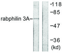 Anti-Rabphilin 3A antibody produced in rabbit affinity isolated antibody
