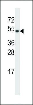 ANTI-TXNDC15(C-TERMINAL) antibody produced in rabbit affinity isolated antibody, buffered aqueous solution