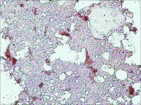 Monoclonal Anti-Collagen, Type X antibody produced in mouse clone COL-10, ascites fluid