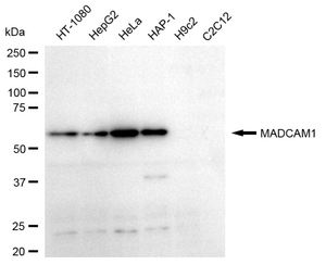Anti MADCAM1 Antibody, clone 24GB660, Rabbit Monoclonal clone 24GB660, recombinant rabbit monoclonal, expressed in HEK293 cells