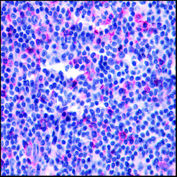 Anti-Leukotriene B4 Receptor BLT2 antibody produced in rabbit affinity isolated antibody, buffered aqueous solution