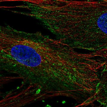 Anti-CHIC2 antibody produced in rabbit Prestige Antibodies&#174; Powered by Atlas Antibodies, affinity isolated antibody