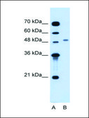 Anti-MGAT2 antibody produced in rabbit IgG fraction of antiserum