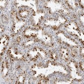 Anti-CIART antibody produced in rabbit Prestige Antibodies® Powered by Atlas Antibodies, affinity isolated antibody, buffered aqueous glycerol solution