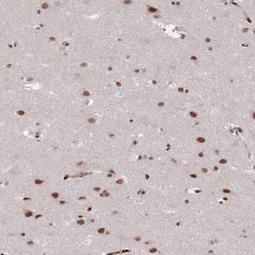 Anti-RFX1 antibody produced in rabbit Prestige Antibodies&#174; Powered by Atlas Antibodies, affinity isolated antibody, buffered aqueous glycerol solution